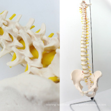 SPINE10 (12382) Quality Medical Science Anatomisches Modell, lebensgroße Wirbelsäule mit Becken